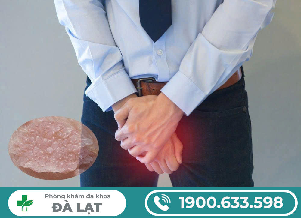 Hình ảnh minh họa